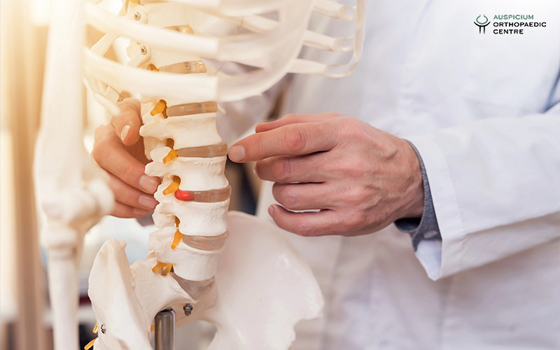 Doctor explaining spine health with a model