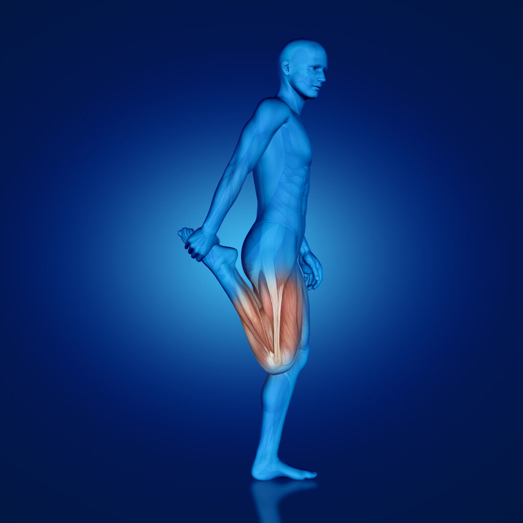 Iliotibial Band Syndrome (ITBS)